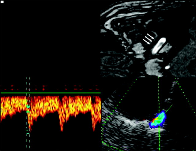 Fig 3.