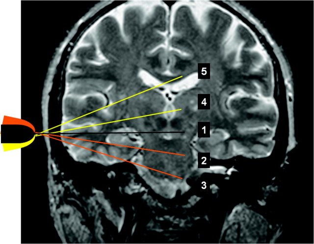 Fig 2.