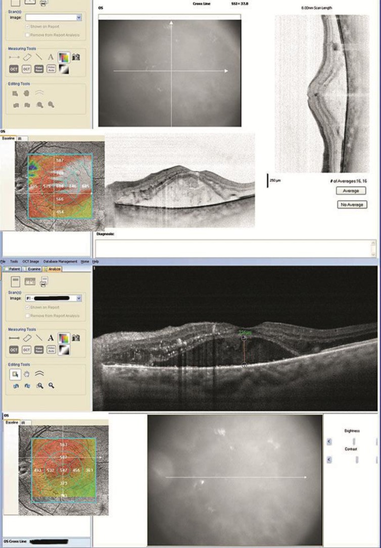 Fig. 3