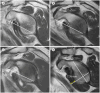 Fig. 3