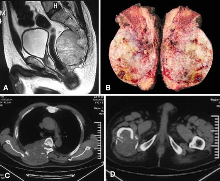 Fig. 1A–D