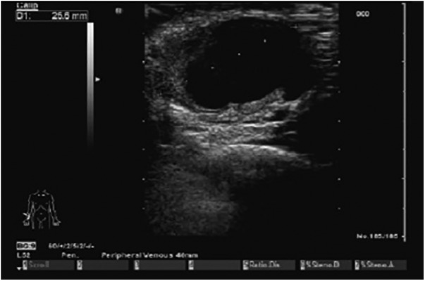 Figure 2