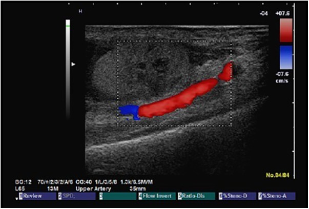 Figure 4