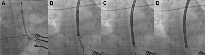 Figure 3