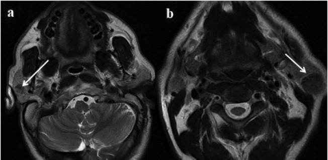 Figure 2a