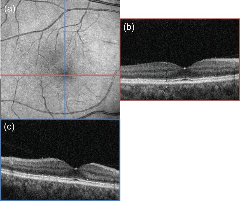 Fig. 10