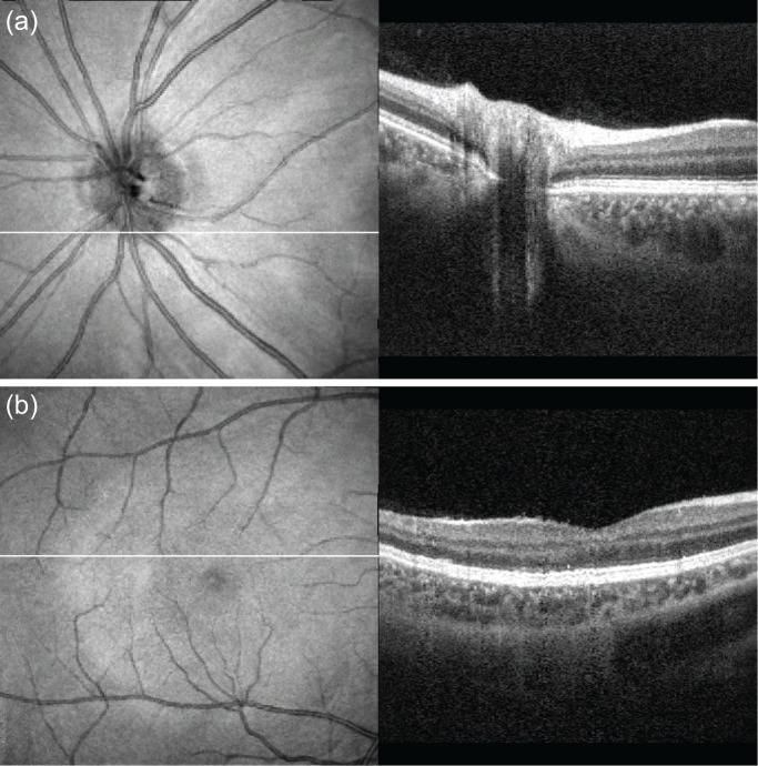 Fig. 11