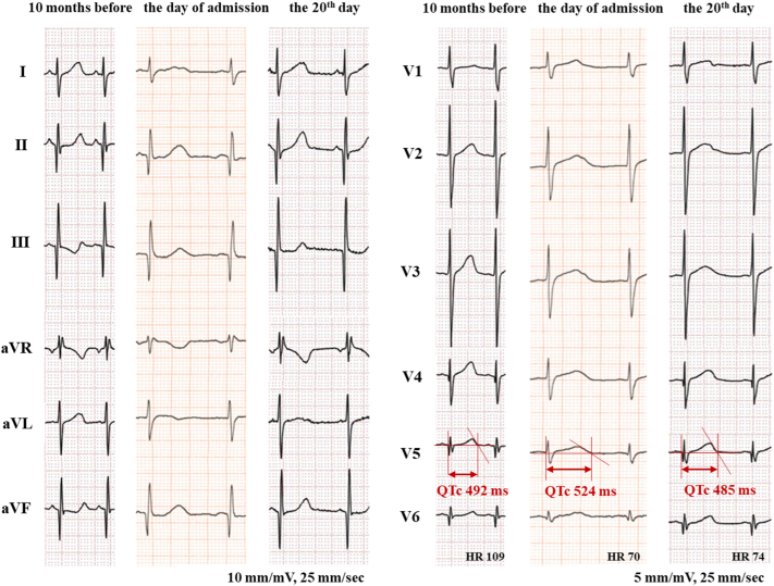 Figure 1