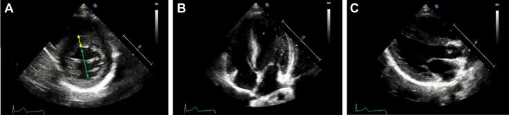 Figure 2