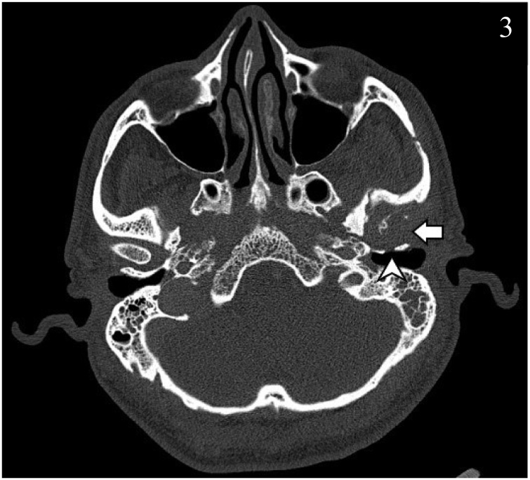 Fig. 3