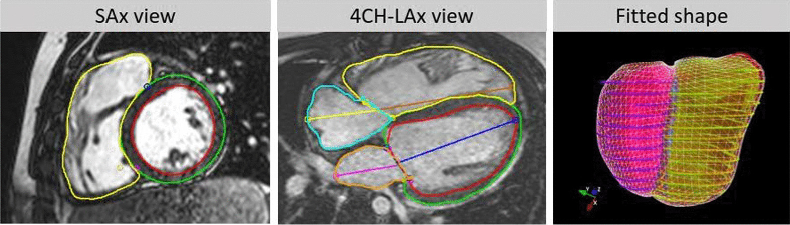 Fig. 1