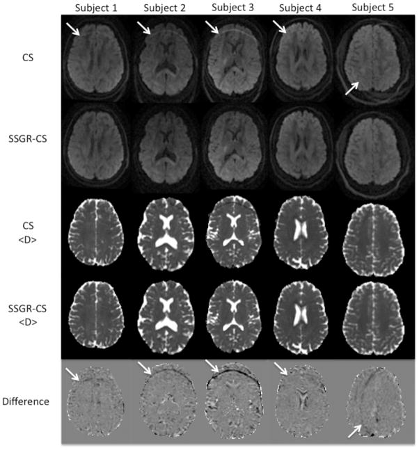 FIG.3