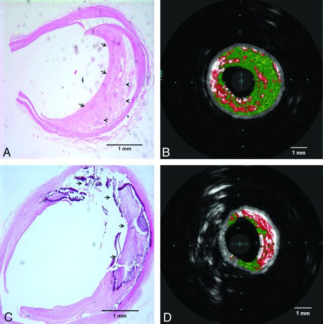 Fig 2.