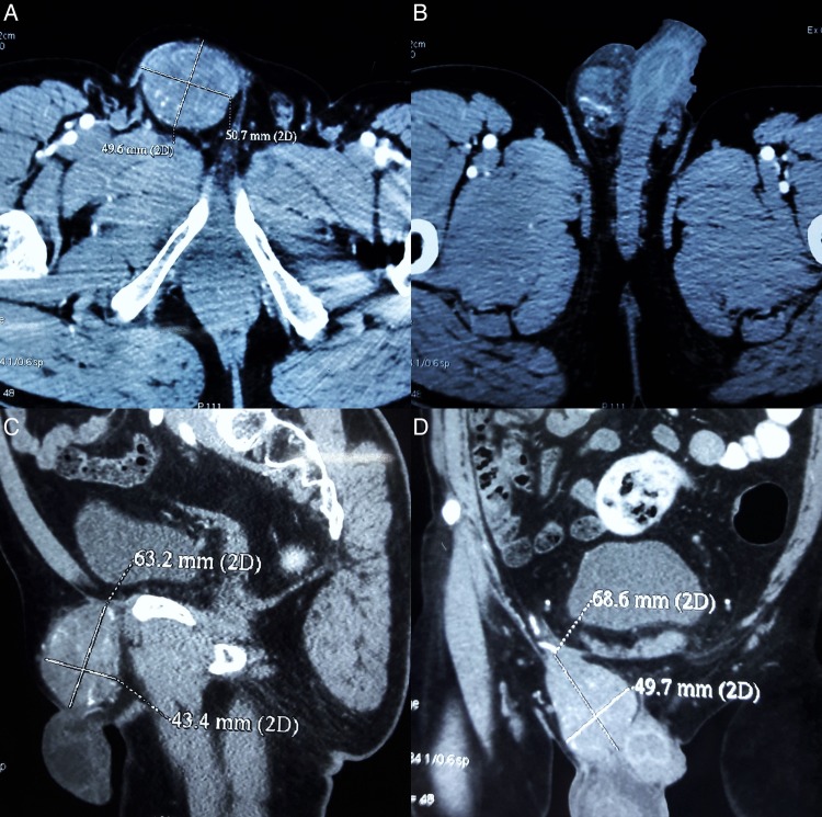 Figure 1