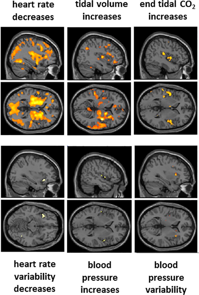 Fig 6