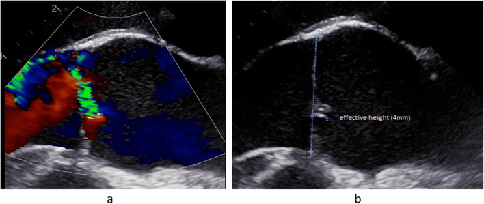 Fig. 6