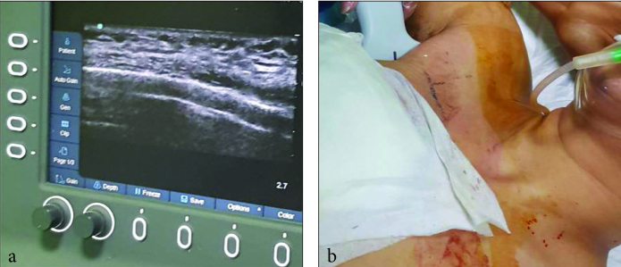 Figure 1. a, b