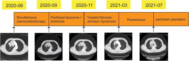 Figure 4