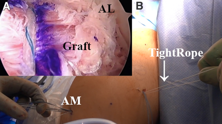 Fig 12