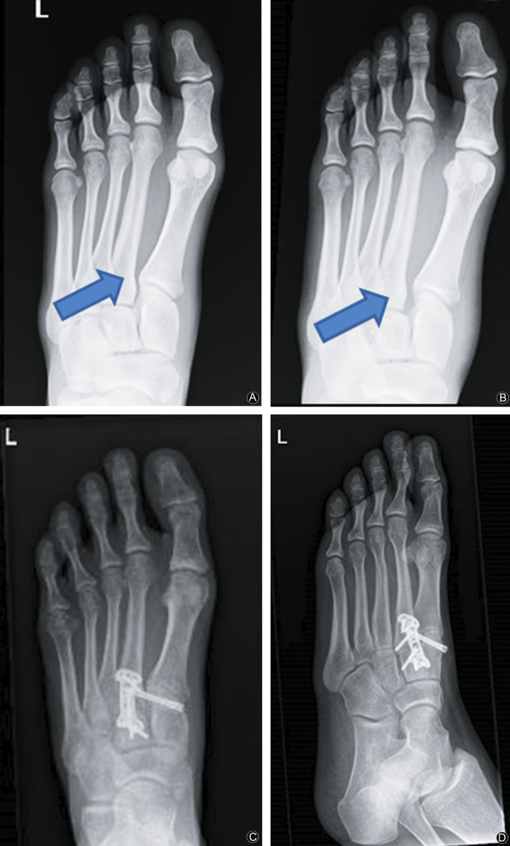 Fig. 1