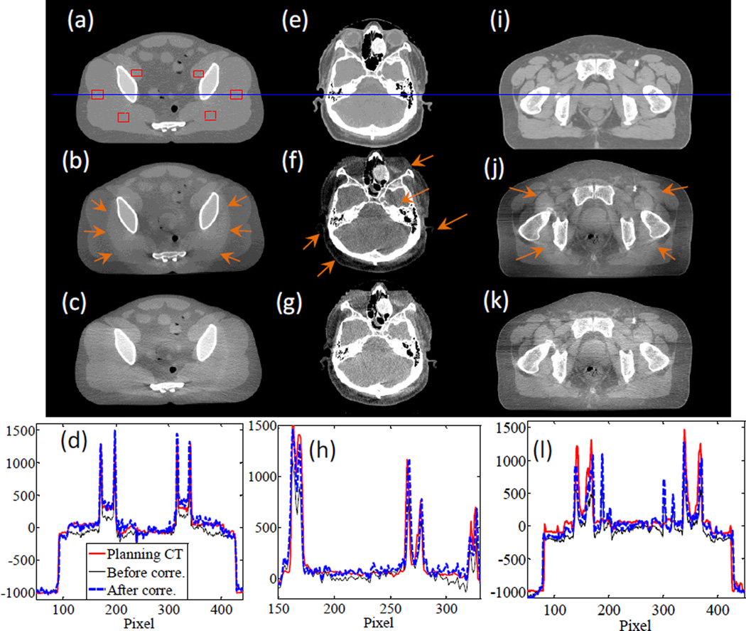 Figure 11