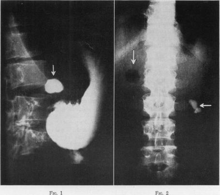 Fig. 1., Fig. 2.