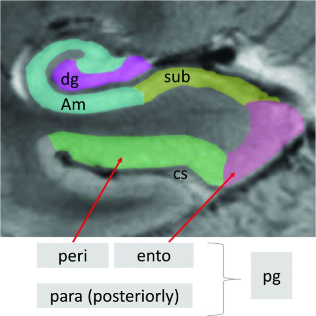 Fig 2.