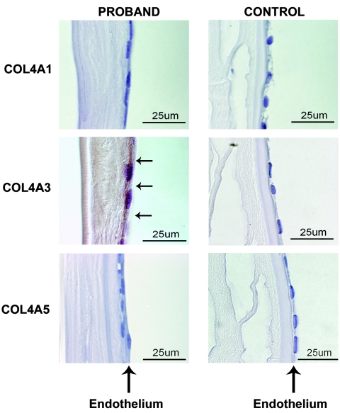 Figure  5