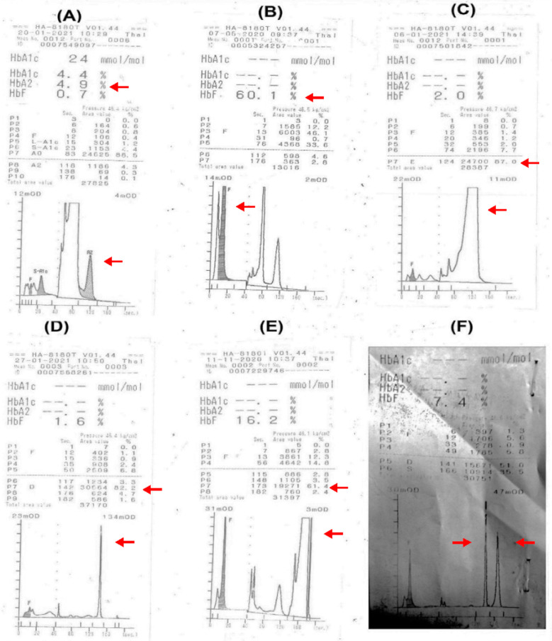 Fig.2