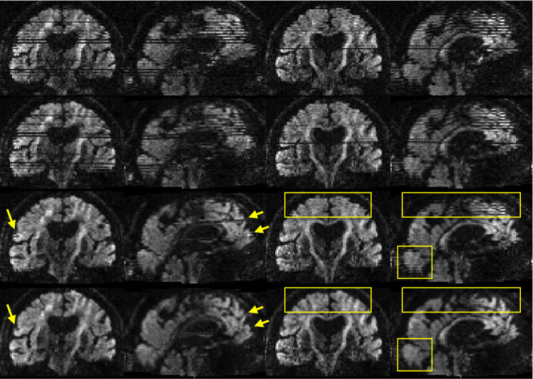 Fig. 17