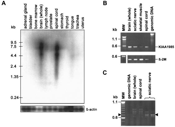 Figure  4