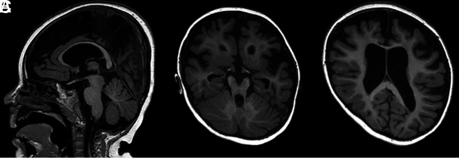 FIG 3.