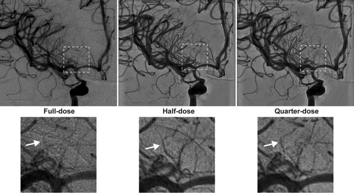 Fig 3.