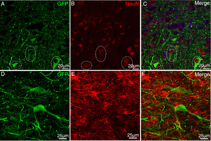 Figure 2—figure supplement 5.