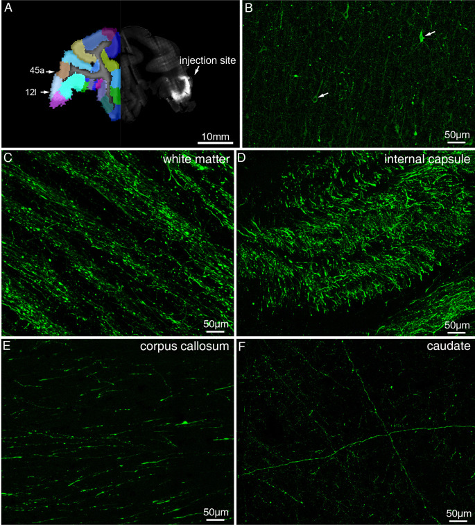 Figure 1—figure supplement 6.