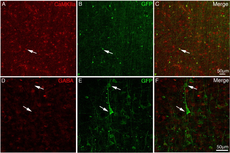 Figure 4—figure supplement 1.