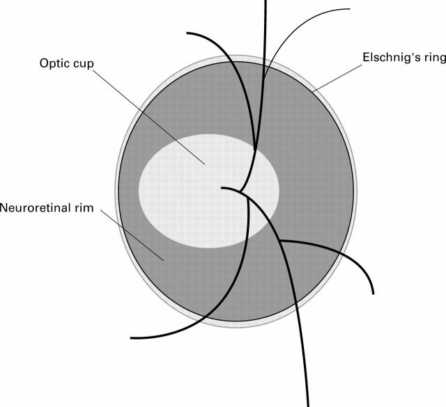 Figure 1  