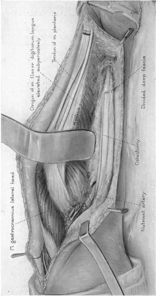 FIG. 8(c).