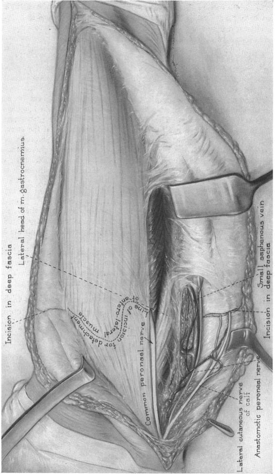 FIG. 7(b).