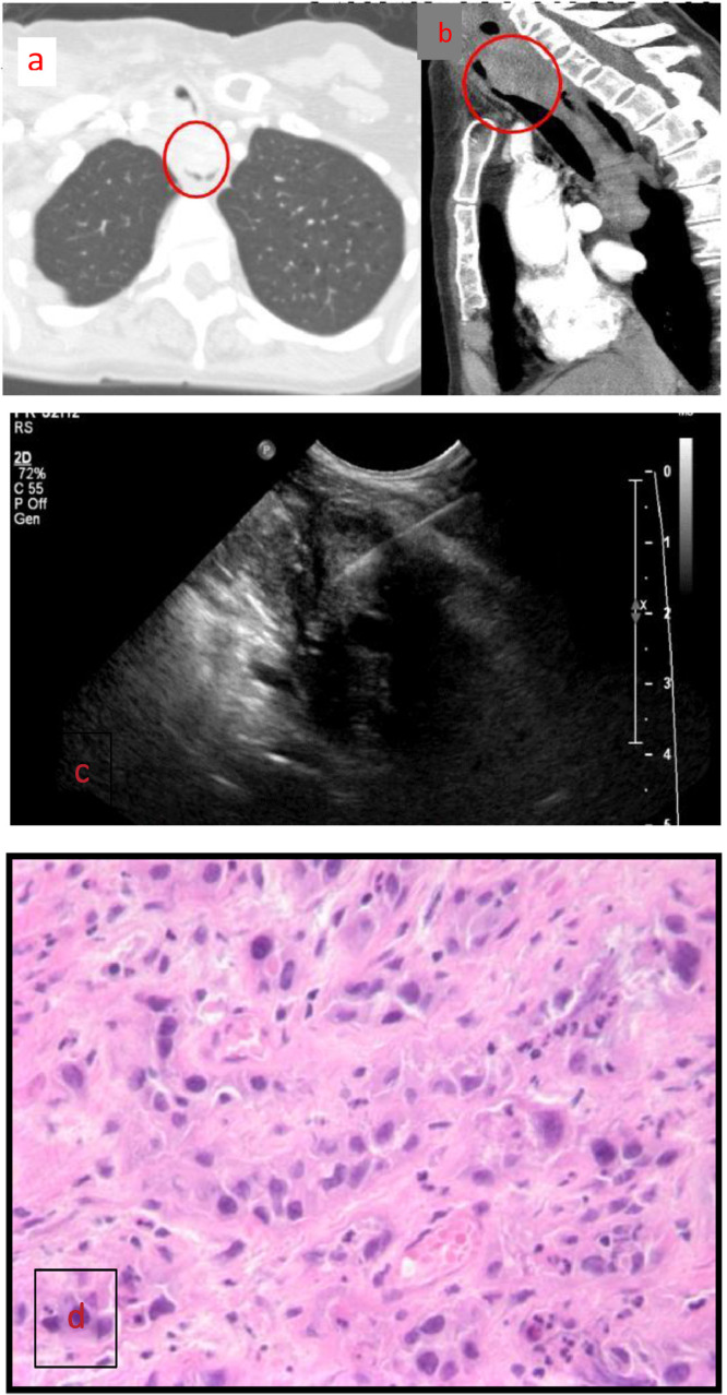 Fig 2