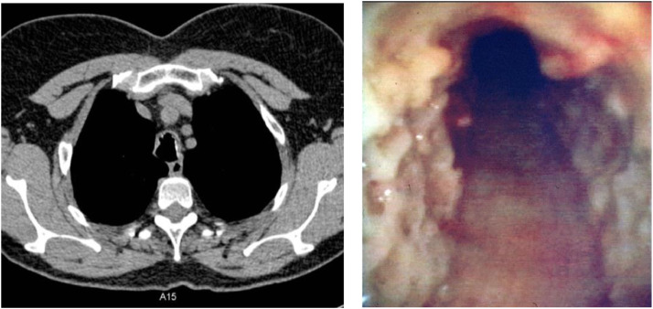 Fig 14