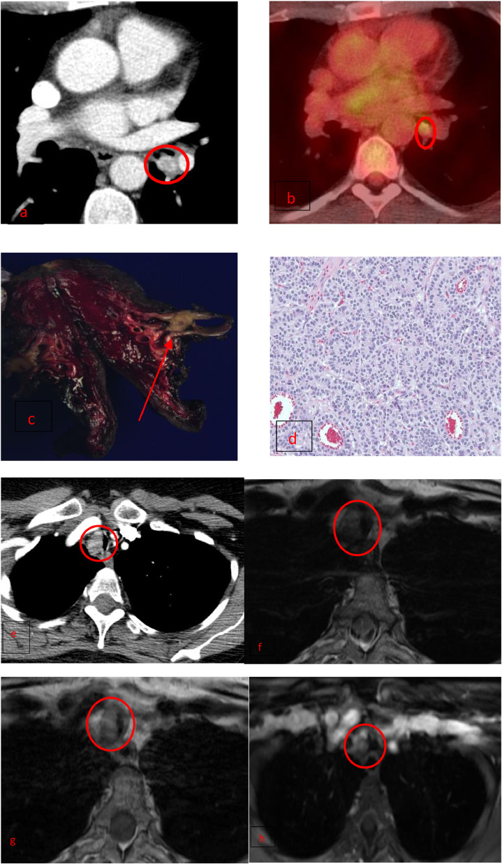 Fig 5