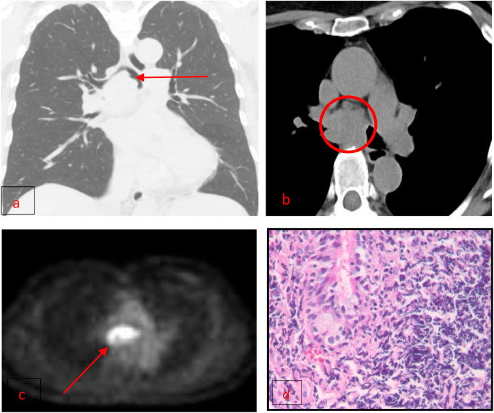 Fig 6