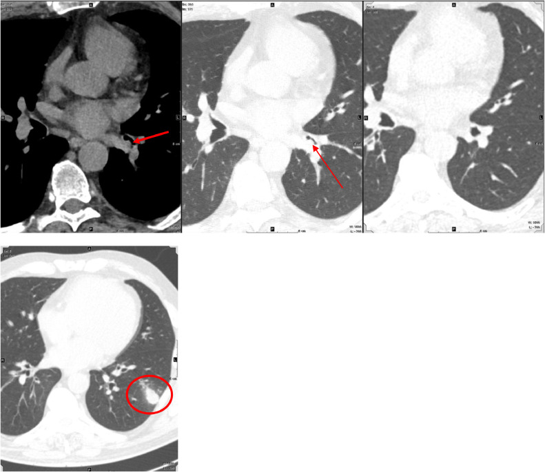 Fig 15