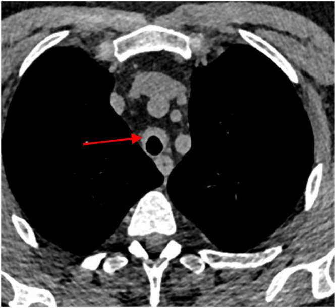 Fig 12