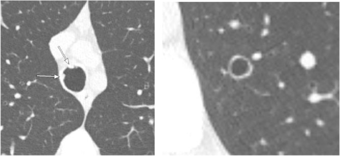 Fig 13