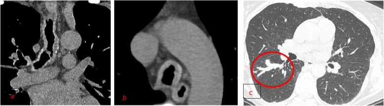 Fig 9