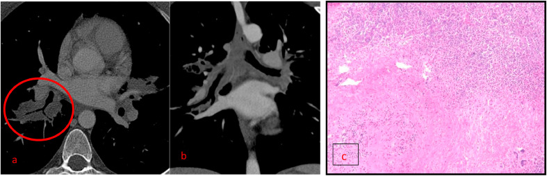 Fig 10