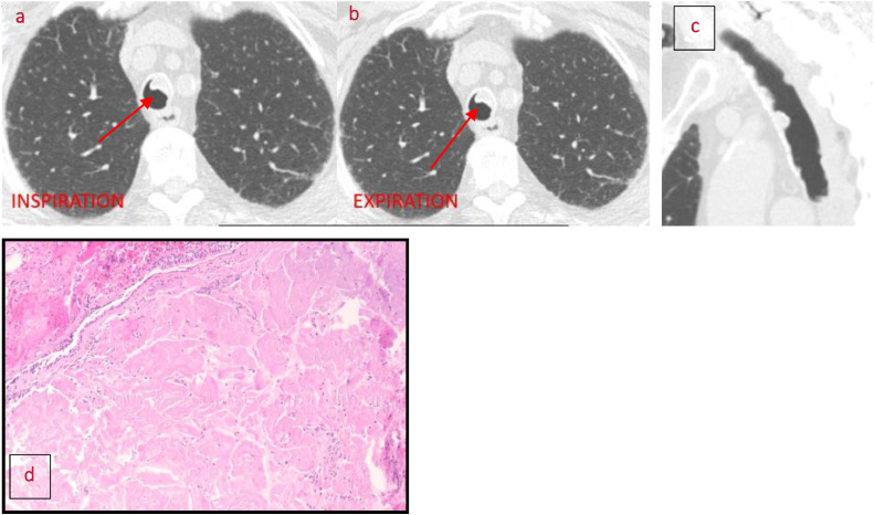 Fig 11