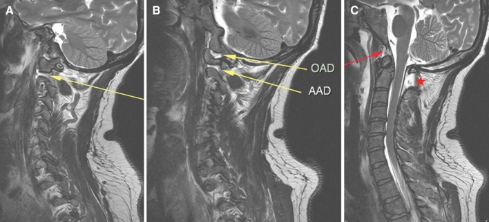 Fig. 4